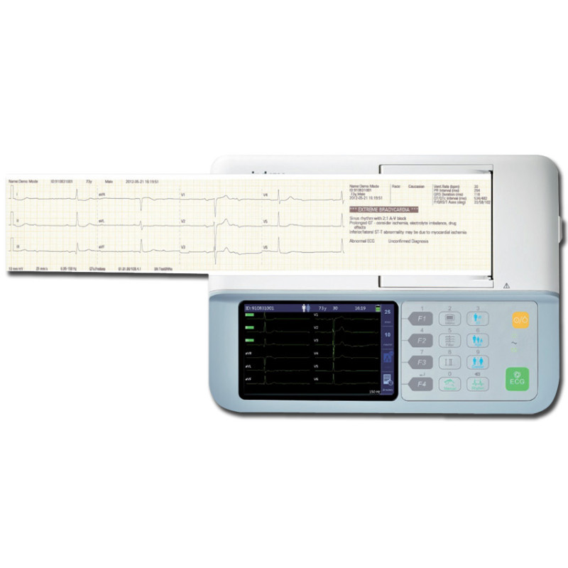 Ecg mindray beneheart R3 cardiografo portatile e leggero per la diagnosi  tramite ECG a riposo