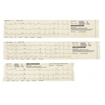 Ecg mindray beneheart R3 cardiografo portatile e leggero per la diagnosi tramite ECG a riposo