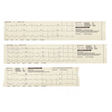 Ecg mindray beneheart R3 cardiografo portatile e leggero per la diagnosi tramite ECG a riposo