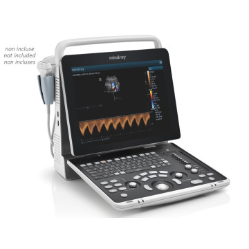 Nuovo ecografo mindray dp-50 expert - 1 pz.