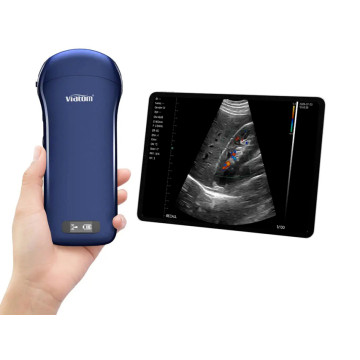 Ecografo Portatile 3 in 1 lineare/convesso/cardiaco Wireless viatom