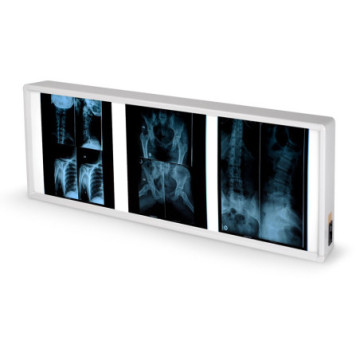 Negativoscopio doppio 38 x 92 cm - 1 pz.