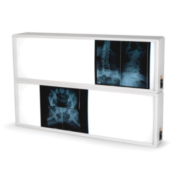 Negativoscopio 2x3 pannelli 76 x 122 cm - 1 pz.