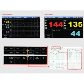 Monitor fetale fc1400 - 1 pz.