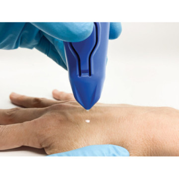 Dispositivo criochirurgico cryomega con cartuccia 16 g - 1 pz.