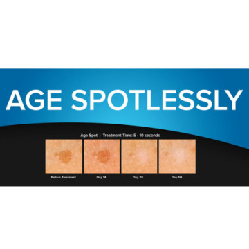 Dispositivo criochirurgico Cryoclear con cartuccia 16 g