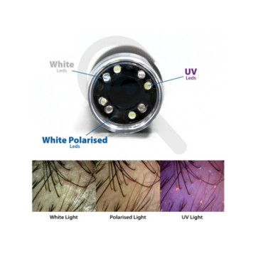 Dermatoscopio a LED polarizzato + UV+Bianchi con software - WiFi e USB