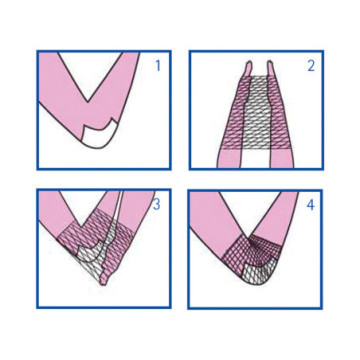 Rete tubolare elastica - calibro 3 per braccio e spalla - 1 pz.