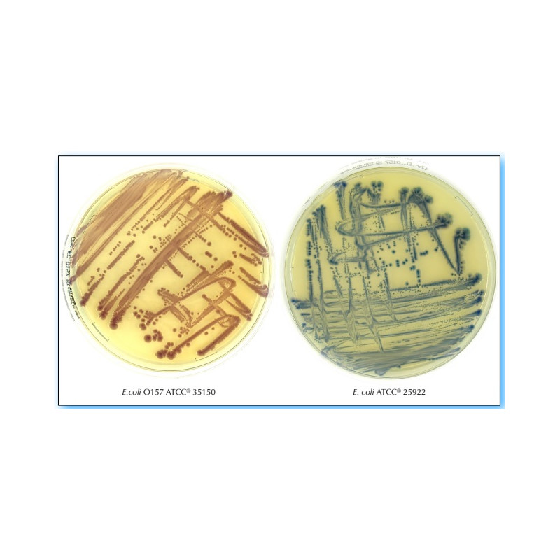 Chromatic E.coli O157 - Piastre da 90 mm pronte all’uso - Conf.20 pz. Chromatic E.coli O157 - Piastre da 90 mm pronte all’uso - Conf.20 pz.