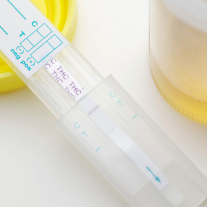 Test droga urine | Securlab