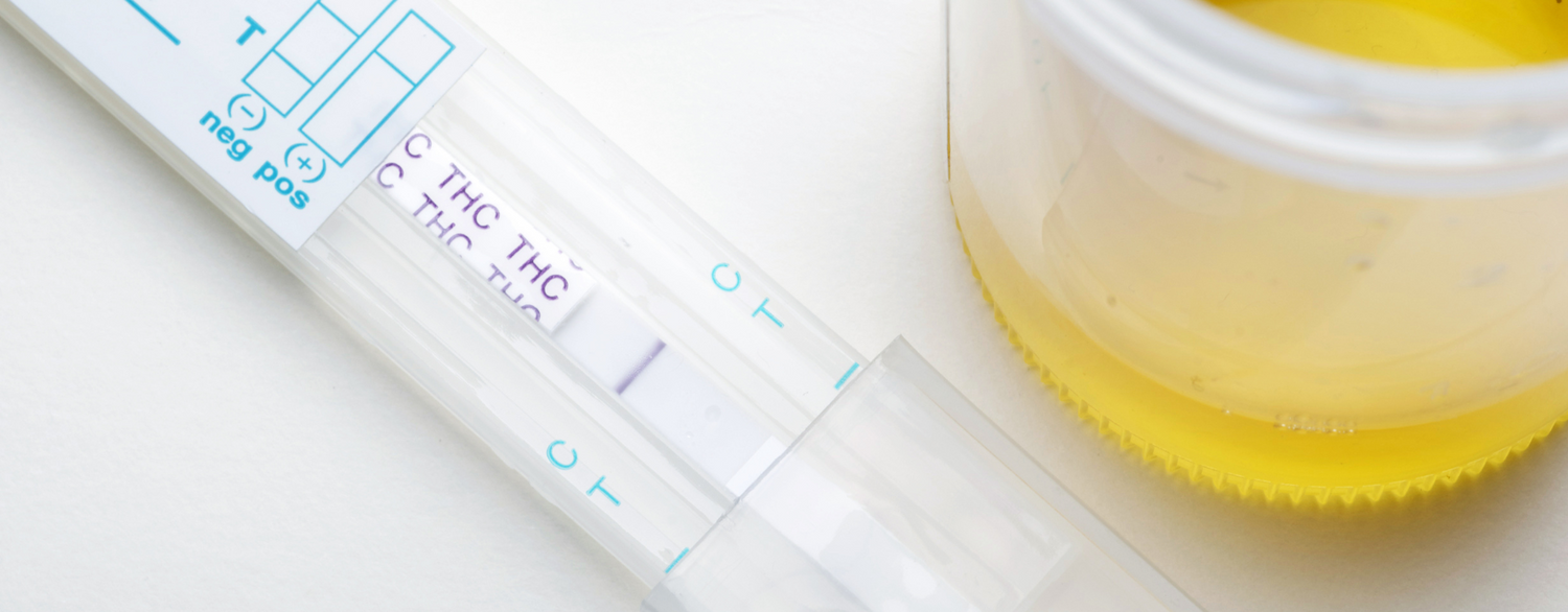 Drug test rapidi sul lavoro: metodi, obblighi ed efficacia