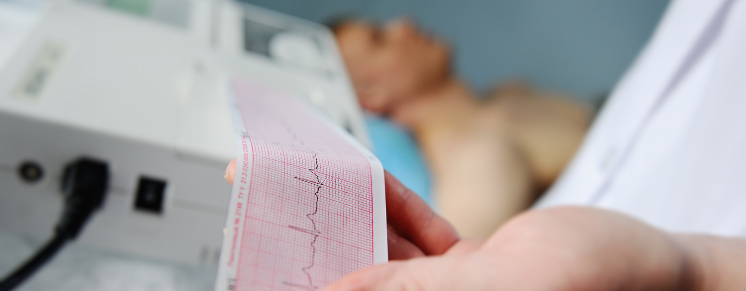 Come scegliere i migliori elettrocardiografi e holter ECG