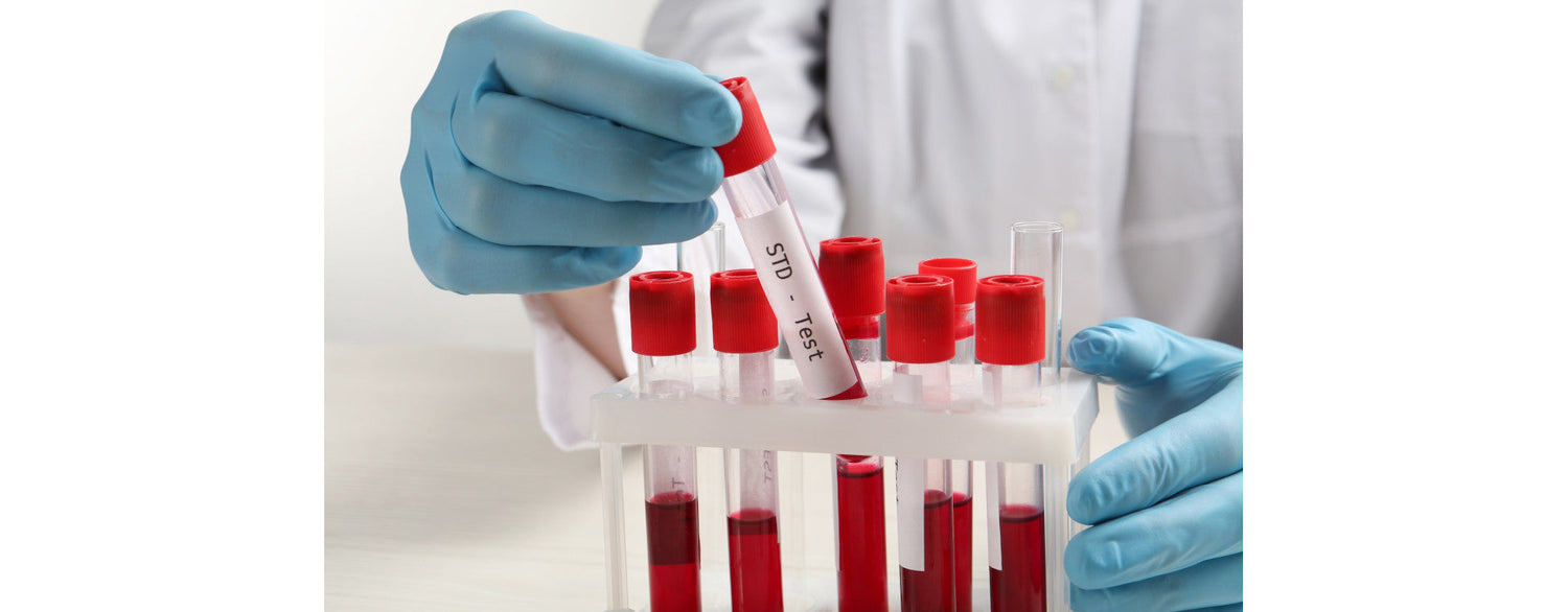Malattie Sessualmente Trasmissibili (MST): Quali Test Fare?