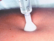 Aghi per micro-mesoterapia Meso-relle con ago tipo S.I.T. 31G 0,26 x 2,5 mm - bianco - Conf.25 pz.