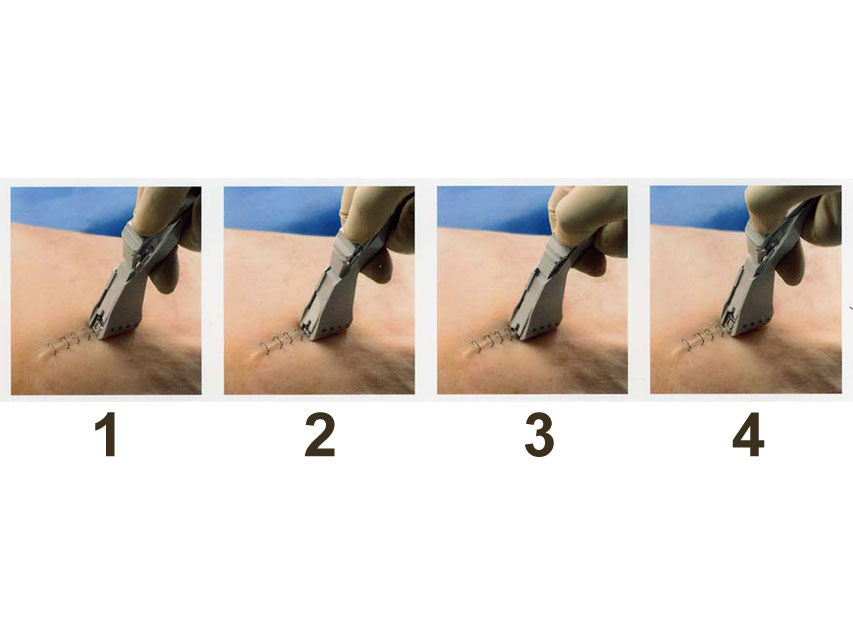 Sututatrice cutanea di precisione  3M - 5 punti - sterile - Conf.12 pz.