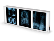 Negatoscope double 38 x 92 cm - 1 pc.