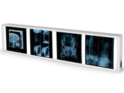 Vierfach-Negatoskop 38 x 153 cm - 1 Stk.
