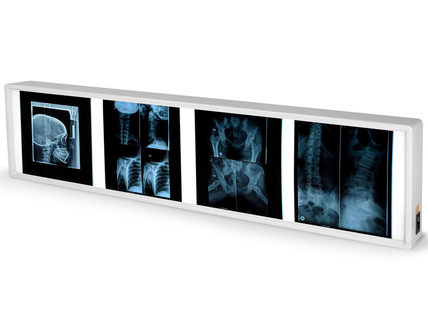 Negativoscopio quadruplo 38 x 153 cm - 1 pz.