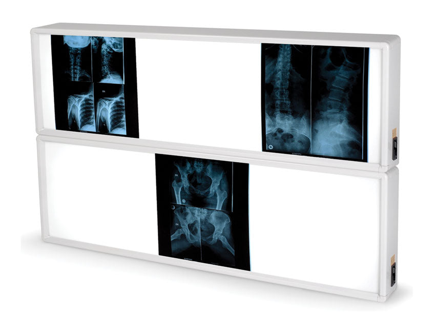 Negativoscopio 2x3 pannelli 76 x 122 cm - 1 pz.
