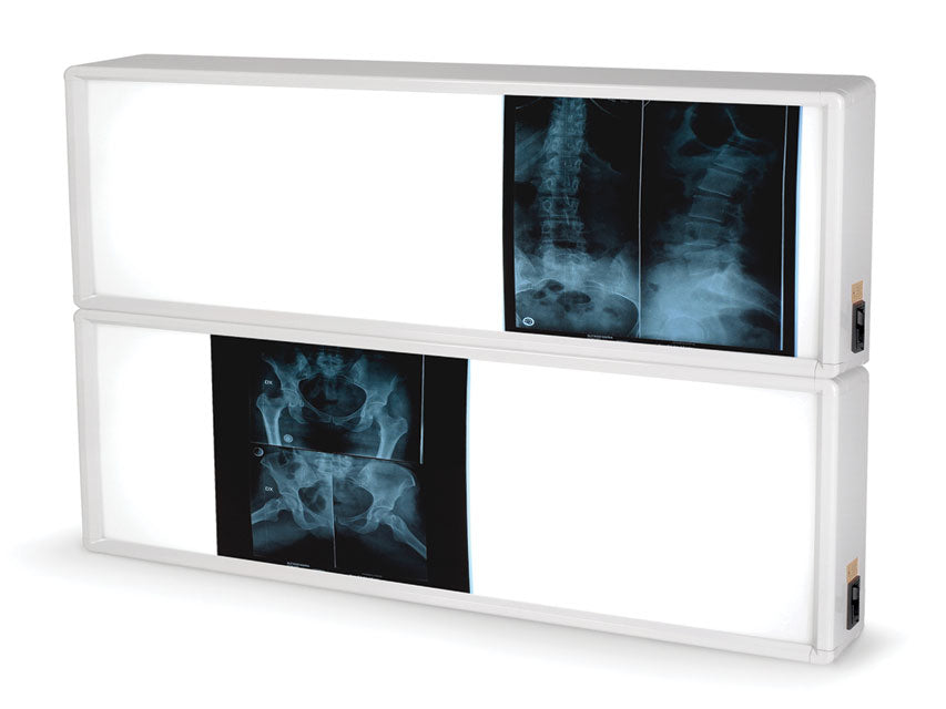 Negativoscopio 2x3 pannelli 76 x 122 cm - 1 pz.
