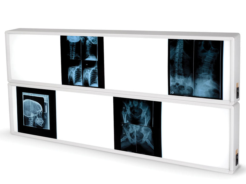 Negativoscopio 2x4 pannelli 76 x 153 cm - 1 pz.