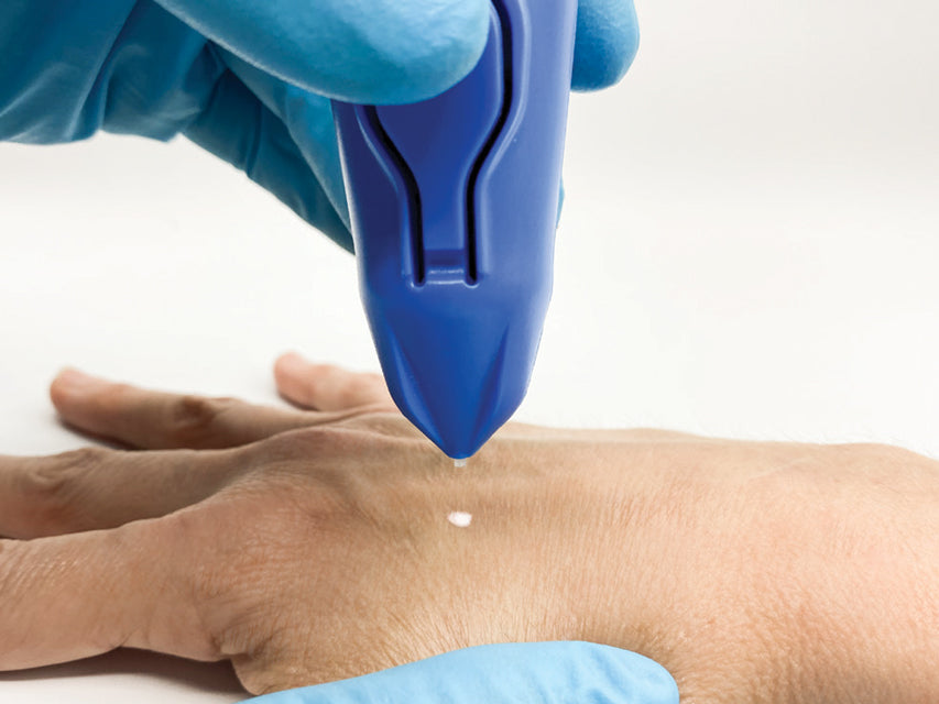 Dispositivo criochirurgico Cryomega con cartuccia 16 g