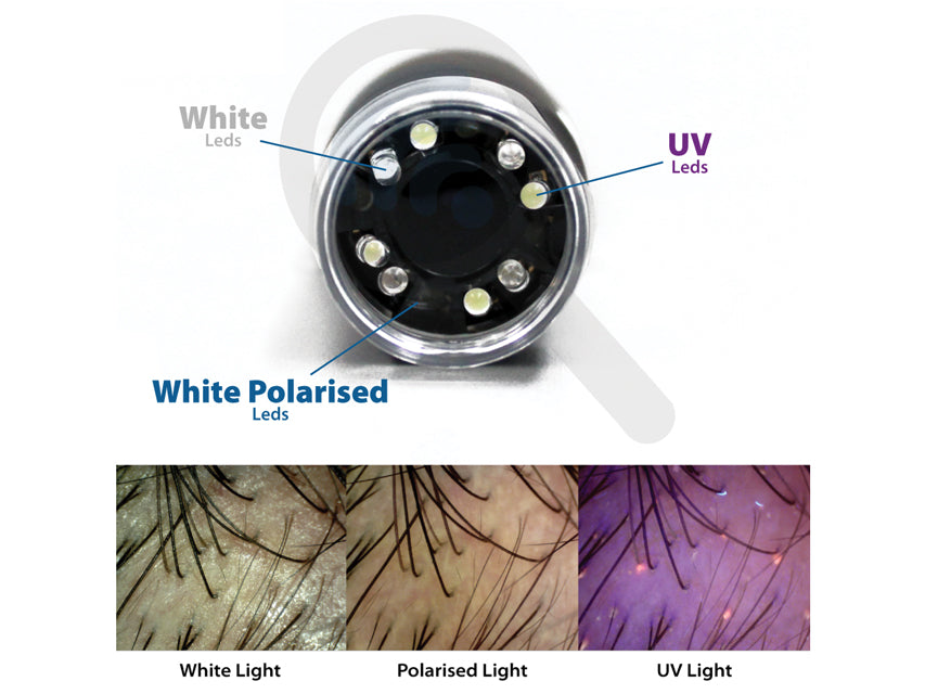 Dermatoscopio a LED polarizzato + UV+Bianchi con software - WiFi e USB