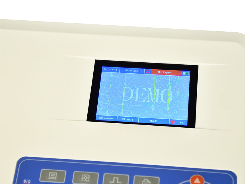ECG Contec 300G - 3 canali con display per 12 derivazioni