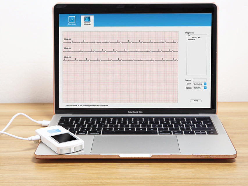 Ecg Palmare PM10 - con software e Bluetooth