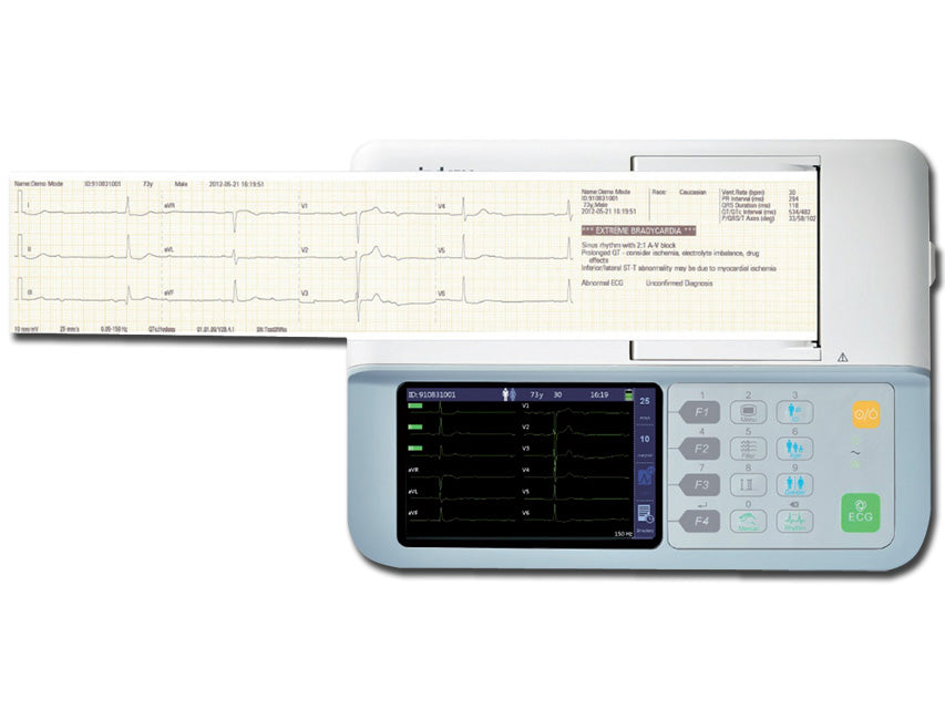 Ecg mindray beneheart R3 cardiografo portatile e leggero per la diagnosi tramite ECG a riposo
