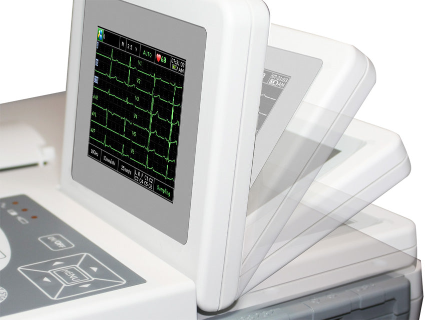 ECG portatili EDAN display a colori elettrocardiografo 12 derivazioni, 3 canali