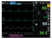 Monitor multiparametrico Gima
Resp+Ecg+SpO2+Nibp+Temp