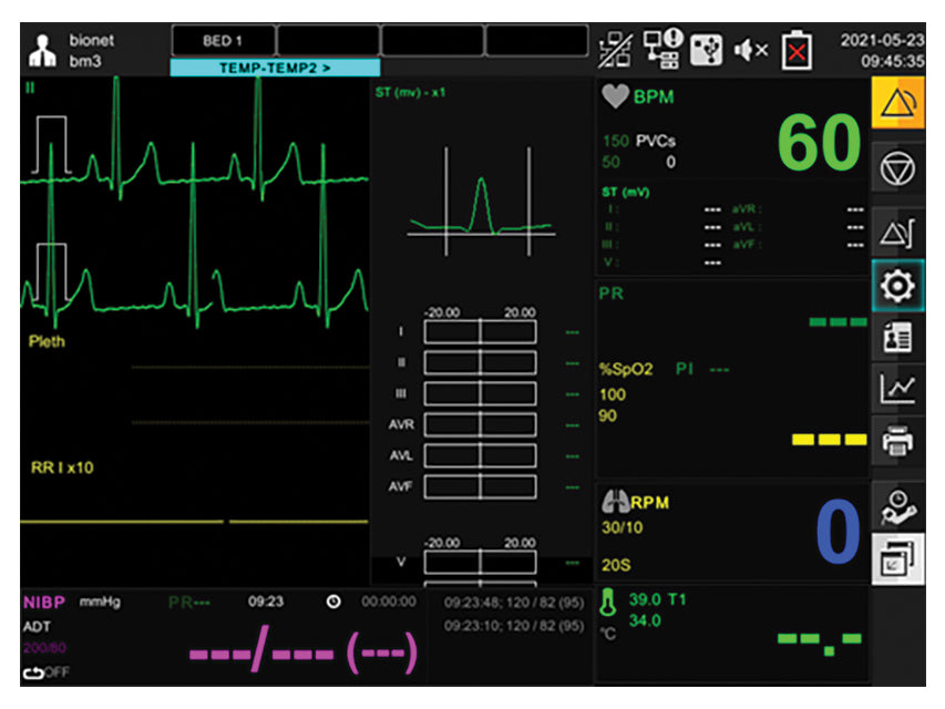 Monitor multiparametrico Gima
Resp+Ecg+SpO2+Nibp+Temp
