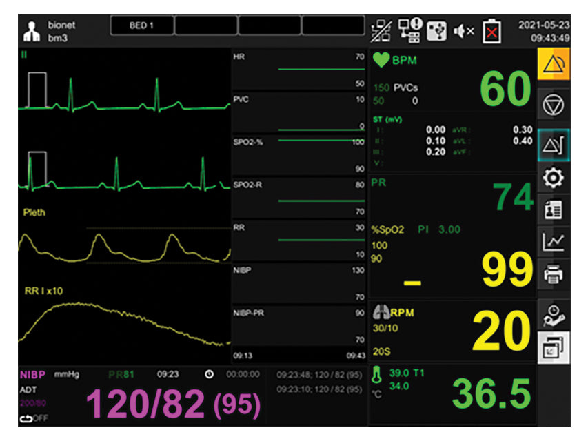 Monitor multiparametrico Gima
Resp+Ecg+SpO2+Nibp+Temp