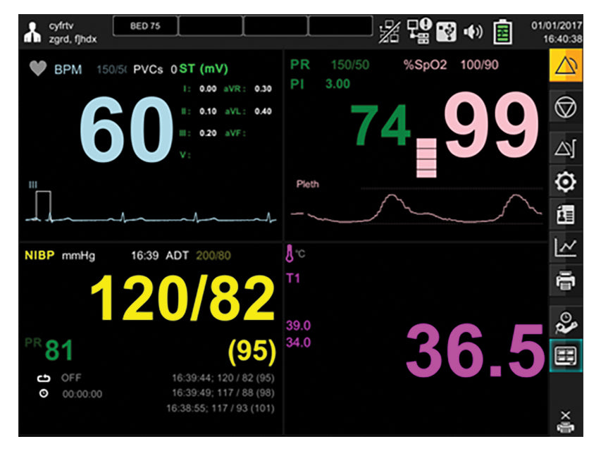 Monitor multiparametrico Gima
Resp+Ecg+SpO2+Nibp+Temp