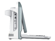 Ecocolordoppler portatile Chison ECO 5 - senza sonde - conf. 1 pz.