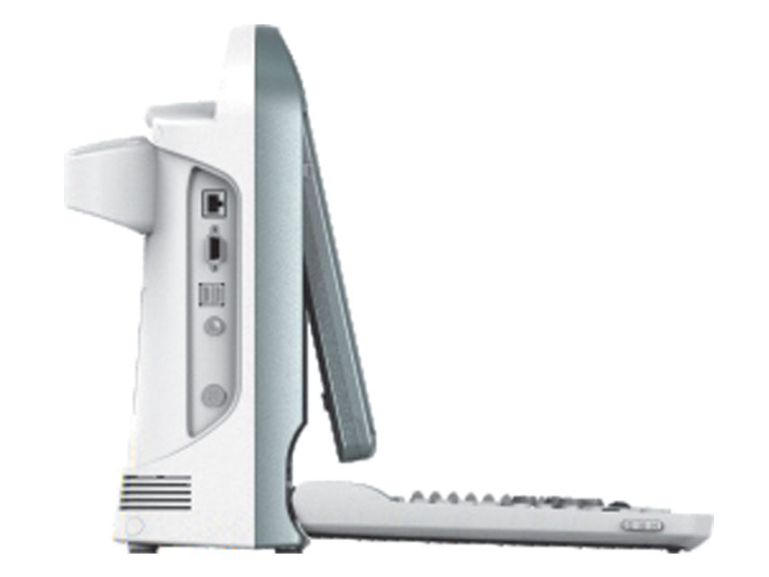 Ecocolordoppler portatile Chison ECO5 VET - senza sonde