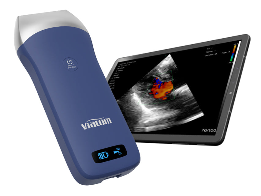 Viatom Ecografo portatile wireless con sonda lineare