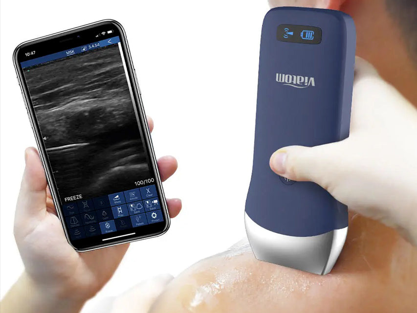 Viatom Ecografo portatile wireless con sonda lineare