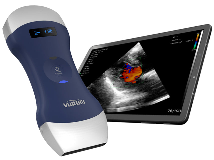 Ecografi Ecocolordoppler