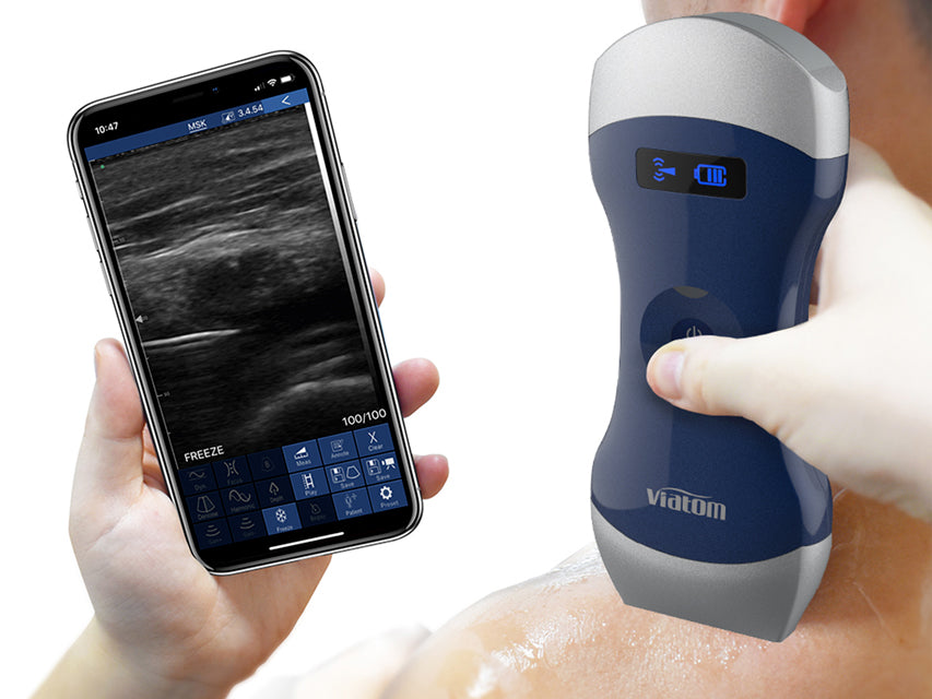 Viatom Ecografo portatile wireless con sonda lineare
