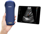 Viatom Ecografo portatile wireless 3 in 1 con sonda lineare, convex e cardiaca