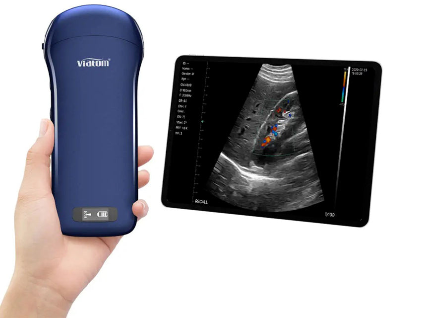 Viatom Ecografo portatile wireless 3 in 1 con sonda lineare, convex e cardiaca
