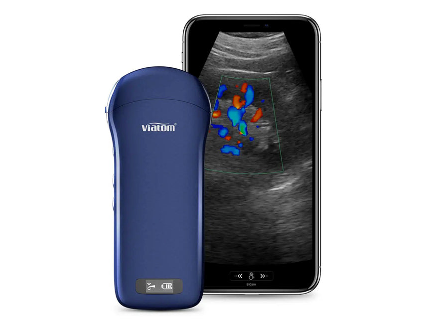 Viatom Ecografo portatile wireless 3 in 1 con sonda lineare, convex e cardiaca