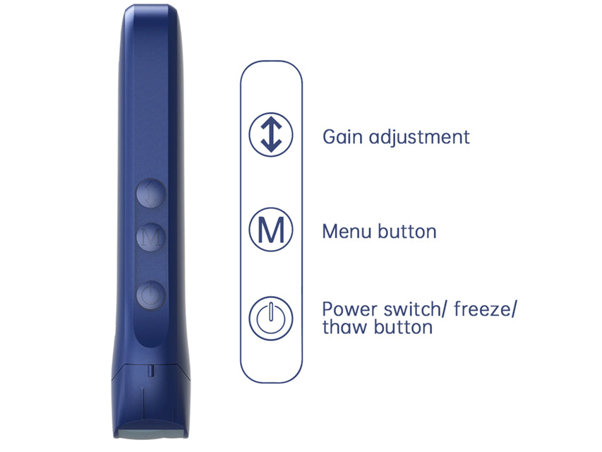 Viatom Ecografo portatile wireless 3 in 1 con sonda lineare, convex e cardiaca