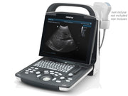 Nouvel échographe portable Mindray DP-20