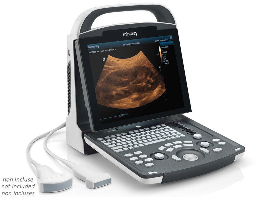 Nuovo ecografo portatile Mindray DP-20