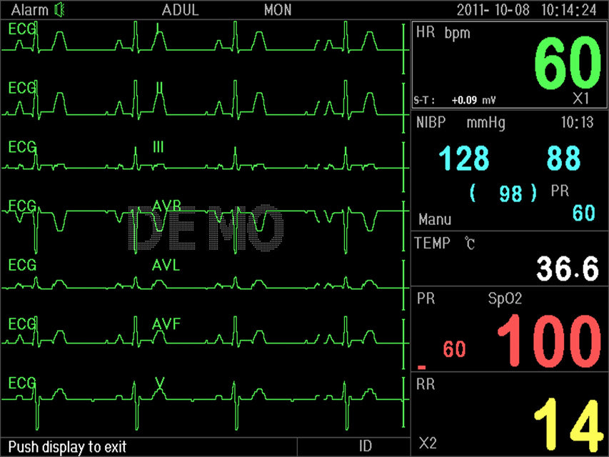 Monitor multiparametrico P3000 - Ecg, SpO2, Nibp, Resp, Temp