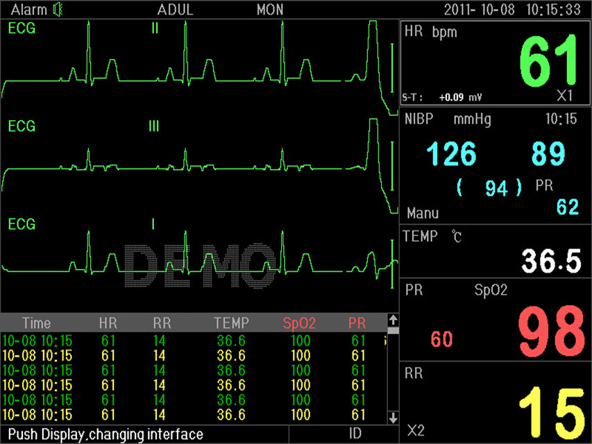 Monitor multiparametrico P3000 - Ecg, SpO2, Nibp, Resp, Temp