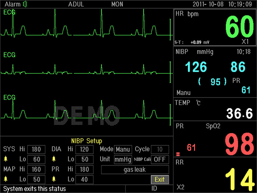 Monitor multiparametrico P3000 - Ecg, SpO2, Nibp, Resp, Temp